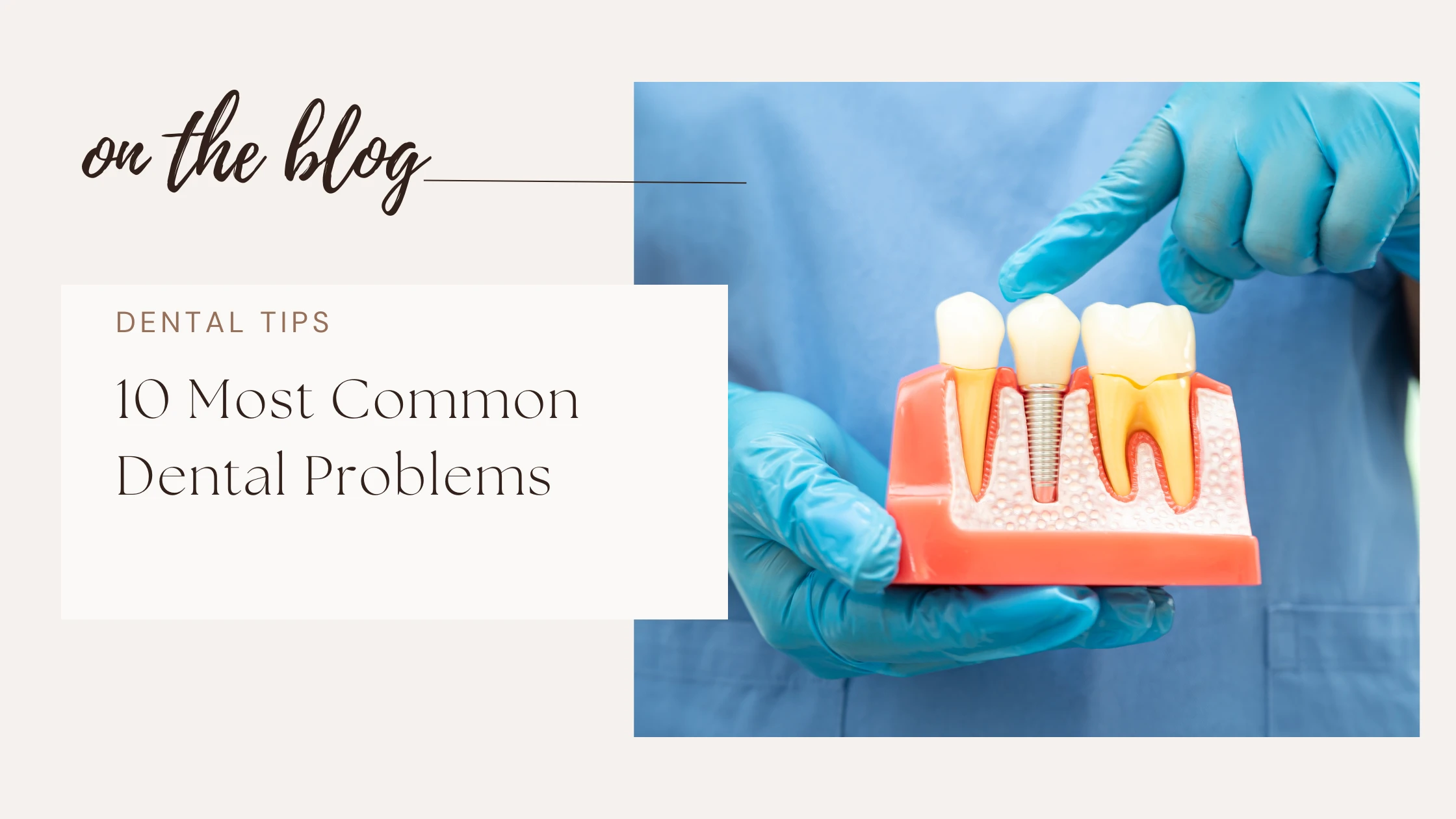 Common Dental Problems